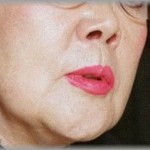 【DQNﾄﾒとﾄﾒ友】「嫁がキツくて辛い」という愚痴を聞いたﾄﾒ友から電話があった「嫁なら嫁らしくつかえた方が後々楽よ！」→旦那「暴れて嫁と息子にけがさせたあげく暴言吐く人は親と思ってません」