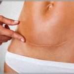 【ムカつく話】ほぼ同時期に帝王切開で出産した弟嫁と私が「産後はきつかったよねー」と盛り上がってたら、バカ弟が信じられない一言を発した