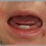 【エネ夫】犬アレルギーの私に「我慢すれば？」と犬を飼い続けた旦那。とうとう子供にもひどい犬アレルギーが出て、追い詰められた私はとんでもないことをしてしまった・・・！