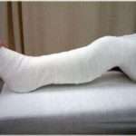 【泣ける話】原チャリで走行中に歩道から飛び出してきた少女を避け片足を失った。生活は不便になったが少女の家庭には懇意にしてもらい金や足よりもいいモノを貰っていると思っている。