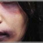 【ＤＶ】彼氏「タトゥーは悪いと思う？」私「未成年ならともかく、成人でその人が責任を取るならそれはその人の選択」彼「はあ？」