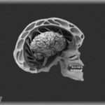 【修羅場】高校の頃、彼氏と喧嘩して背後から車で撥ね飛ばされた。気をひきたかったらしいが、打ち所が大変悪く脳挫傷で生死をさまよった。
