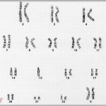 【復讐】性染色体異常で幼いときは「中性的な見た目の男」だと思われていたが、自覚している性は女性だった→手術等をして肉体も戸籍も女性になったが、そこからの人生も壮絶だった。