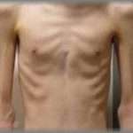 【弟嫁】弟が倒れたと聞いて病院に駆けつけると、そこには見る影もなくやせ細った弟の姿が・・・「ひどい栄養失調です」という医者の言葉に唖然としてると、そこに丸々と太った弟嫁がやってきて・・・