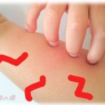 【糞トメ】義実家でトメウトに「体調悪い時に魚介・甲殻類や苺を食べると蕁麻疹がでるんですよ～」と話したら、病気になった時コトメがやってきて「はい、お母さんから苺。蟹雑炊の材料も渡されたから作るね！」