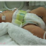 【葛藤】先天性食道閉鎖症で産まれた赤ちゃん。ミルクが飲めないので一刻も早く手術しないと助からない。親に説明をして手術承諾書をもらおうとしたら、なんと親は拒否。病院と児童相談所がどんなに説得しても聞き入れず、結局赤ちゃんは・・・