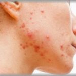 【衝撃】両親と同居している兄夫婦。親父がもらい事故で、母が病気でダウンしてしまい兄嫁だけでは辛いので週2で俺嫁に顔を出してもらっていた。しかし