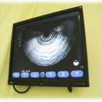 【DQN返し】現在妊娠7ヶ月。夫実家は子供の性別を知りたがり、私実家は生まれてからの楽しみにしたいと言われていた。あまりにも夫実家がしつこいので