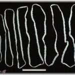 【閲覧注意】十年くらい前、排便中にサナダ虫が。白い紐状の物体がにゅるにゅると。家族には誰も言えないまま、翌日学校休んで病院へ行ったら……